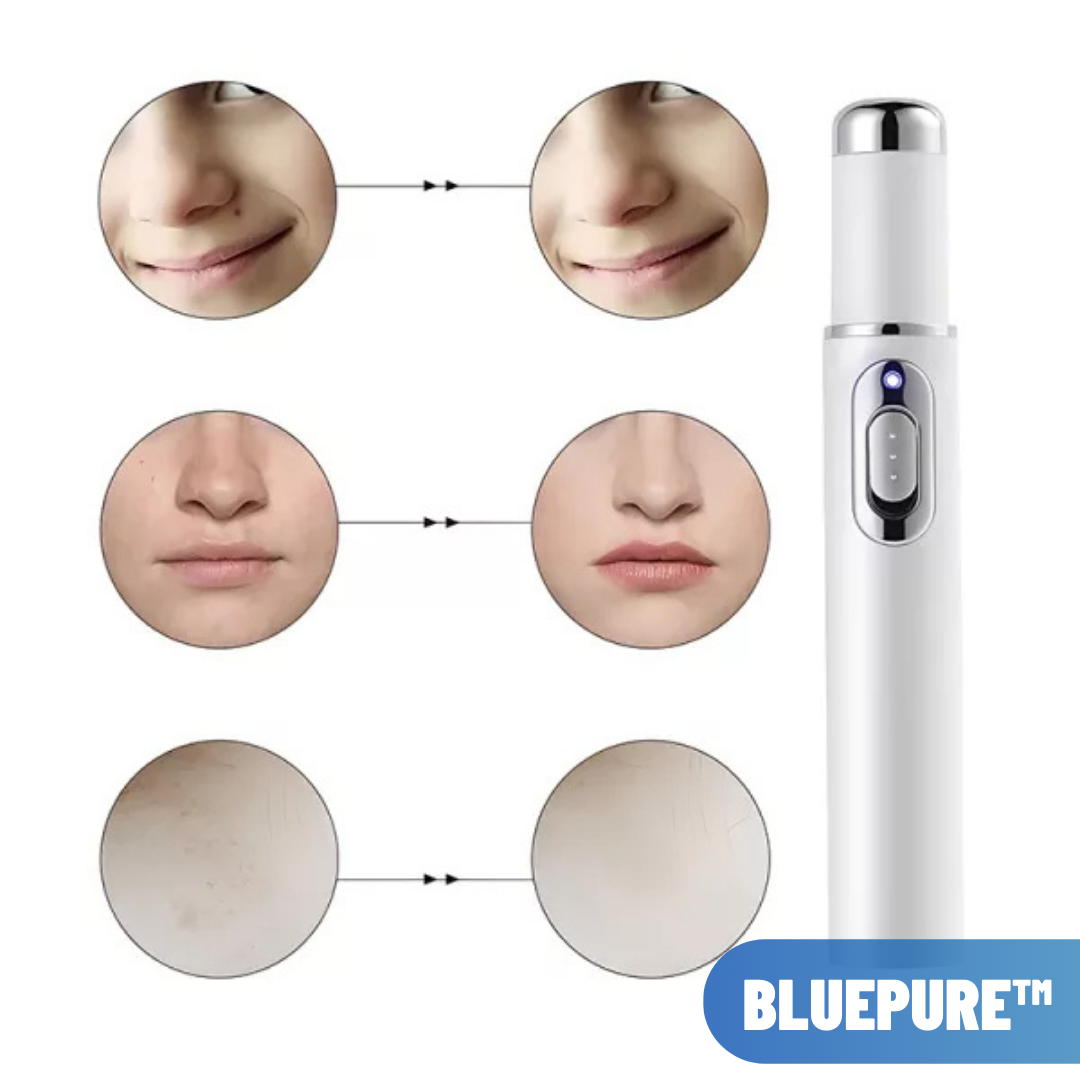 BluePure™: Elimina Imperfecciones y Resalta Tu Belleza 😍