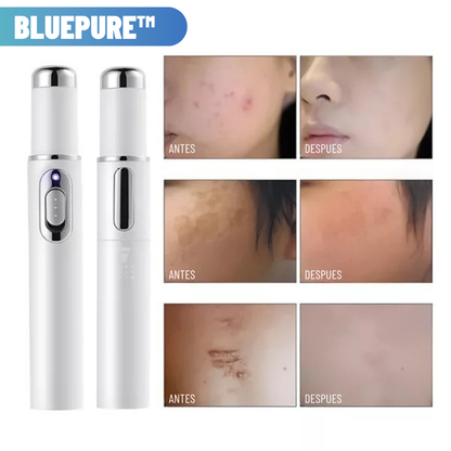 BluePure™: Elimina Imperfecciones y Resalta Tu Belleza 😍